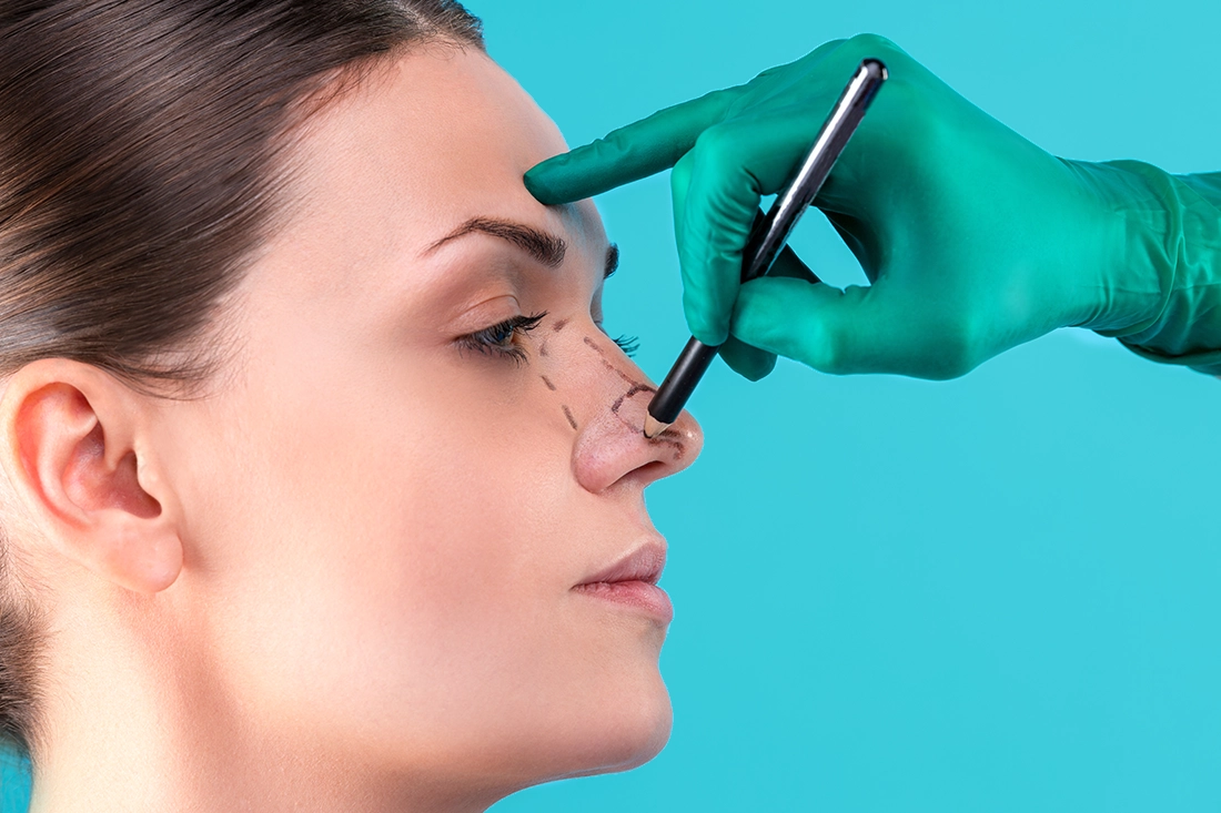 عملية تجميل الأنف في تركيا