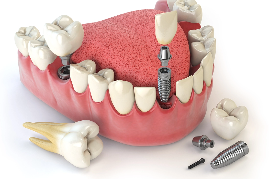 تجميل وعلاج الاسنان