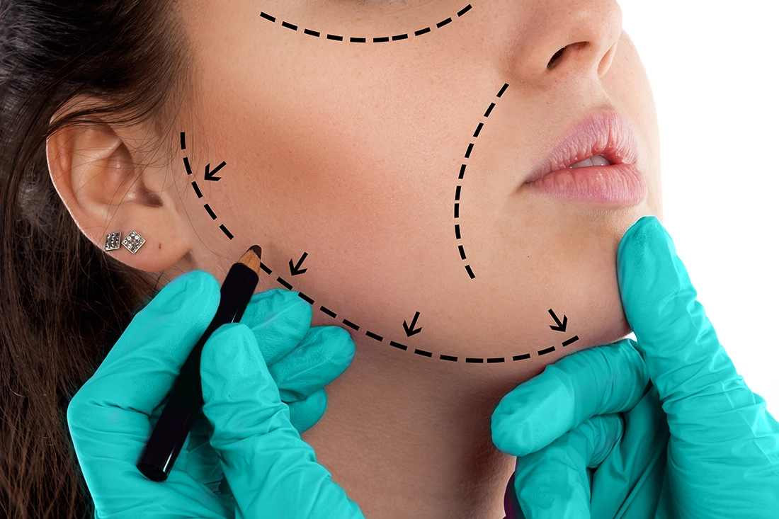 عمليات تجميل الوجه