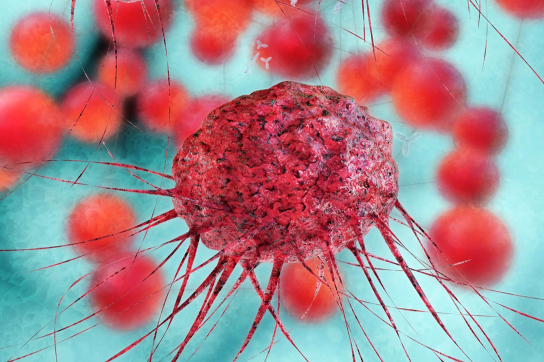 o9Medical - Cancer Surgery in Turkey