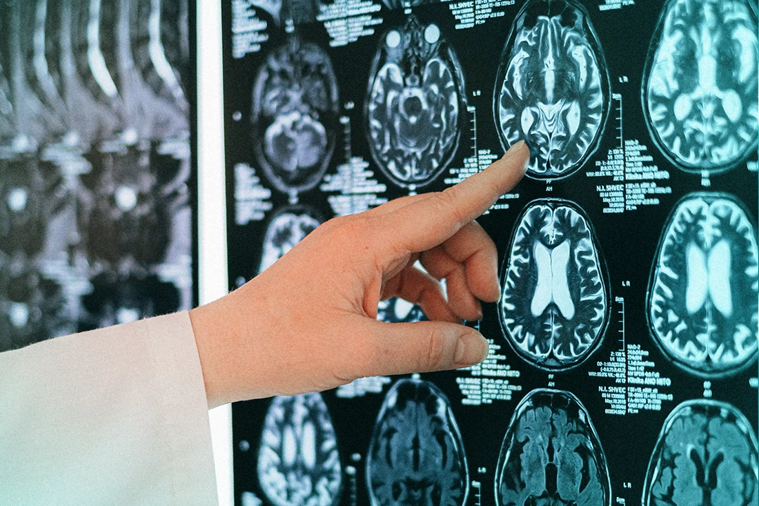 o9Medical - Best Neurosurgery Hospitals in Turkey