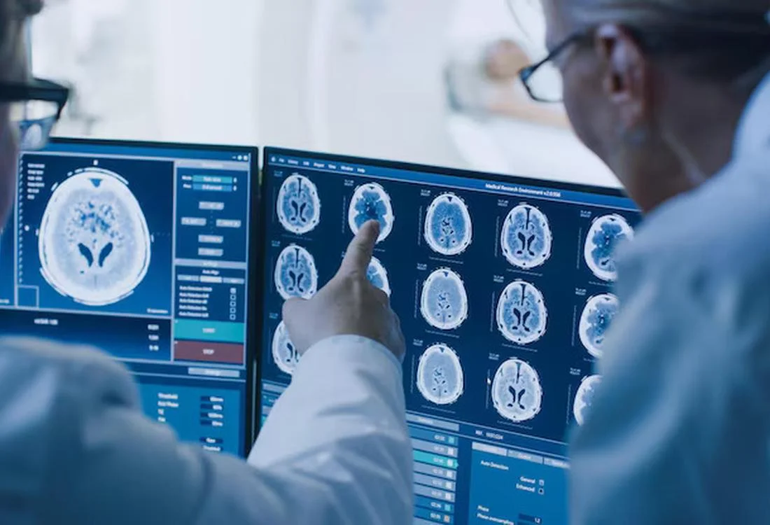 o9Medical - Treatment of Aneurysms in Turkey